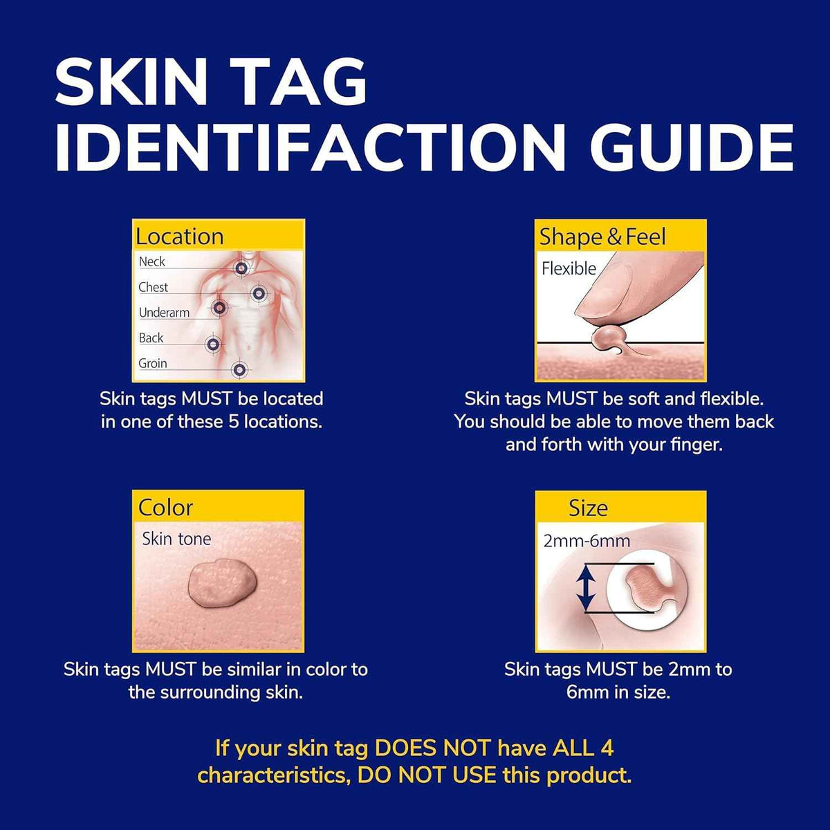 Dr. Scholl's Freeze Away Skin Tag Remover - At Home Skin tag Removal kit. Clinically Proven Skin Tag Removal in as Little as 1 Treatment. 1 Skin tag Removal kit, 12 Treatments 🍁 All In One Marketplace Canada