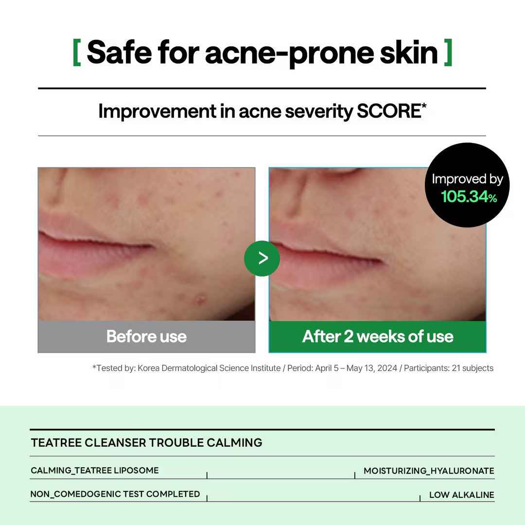 Mediheal Teatree Cleanser_Trouble Calming 120ml