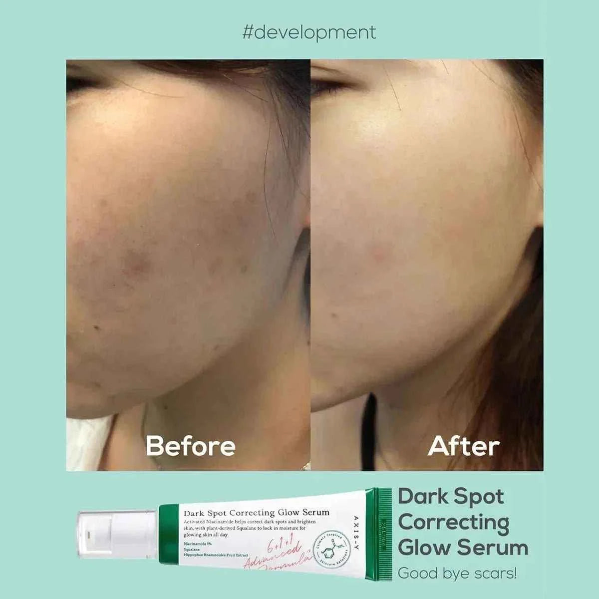 Axis-y Dark Spot Glow Serum 50ml
