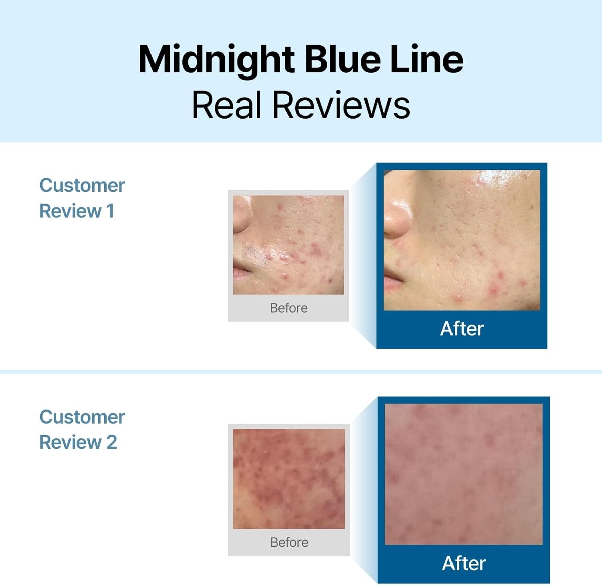 Dear, Klairs Midnight Blue Calming Cream 60ml
